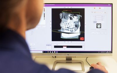 ConeBeam, quanto è importante l’utilizzo della diagnostica 3D